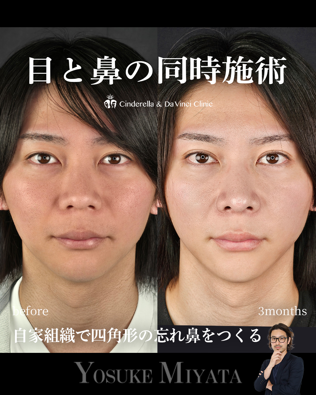 目と鼻同時の画像