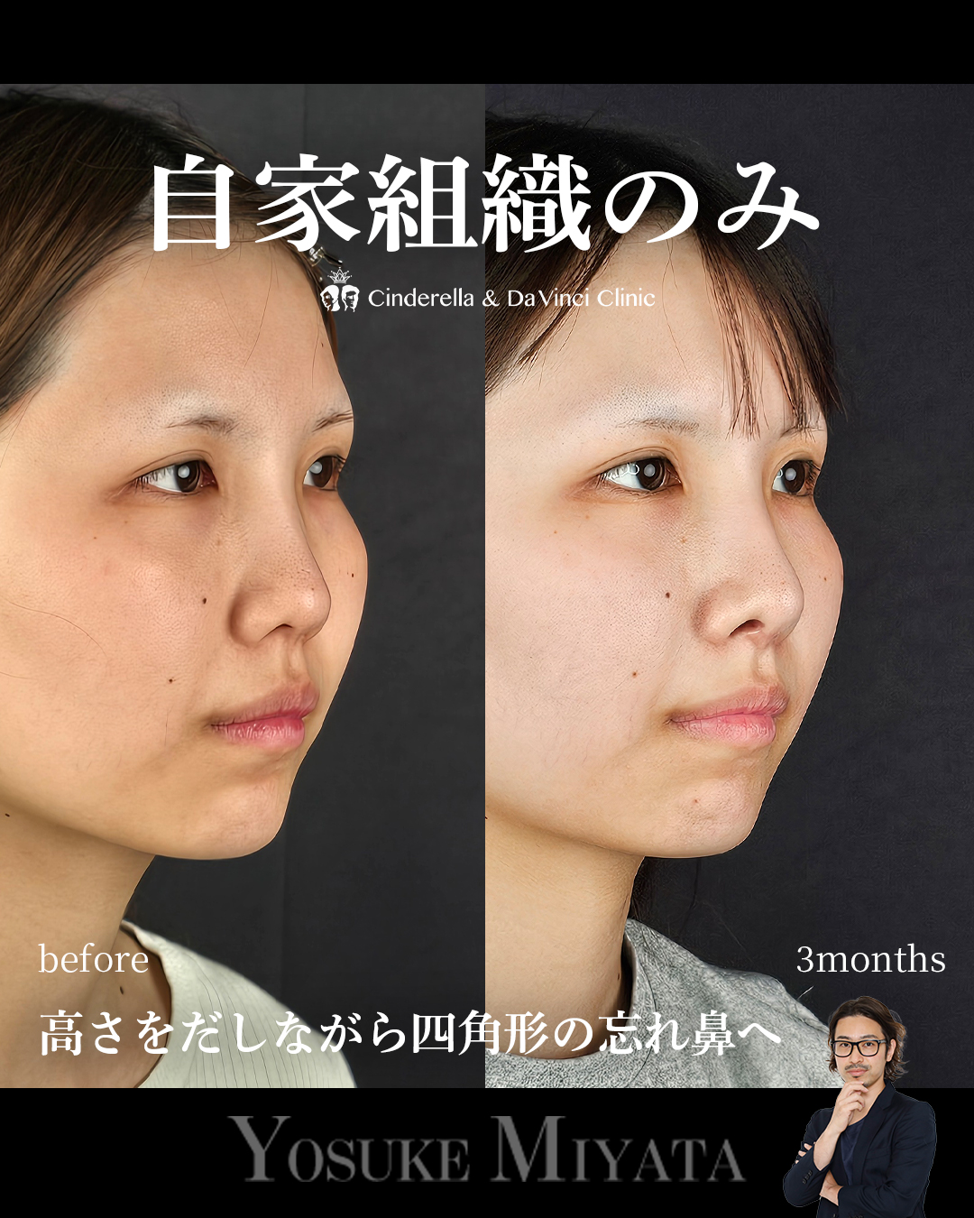 自家組織のみの画像