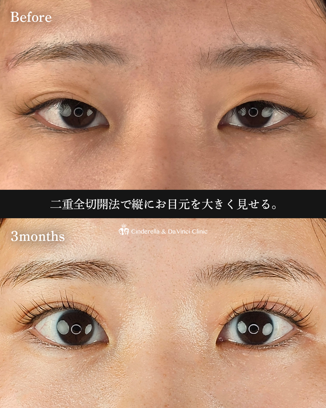 目元ぱっちりの画像