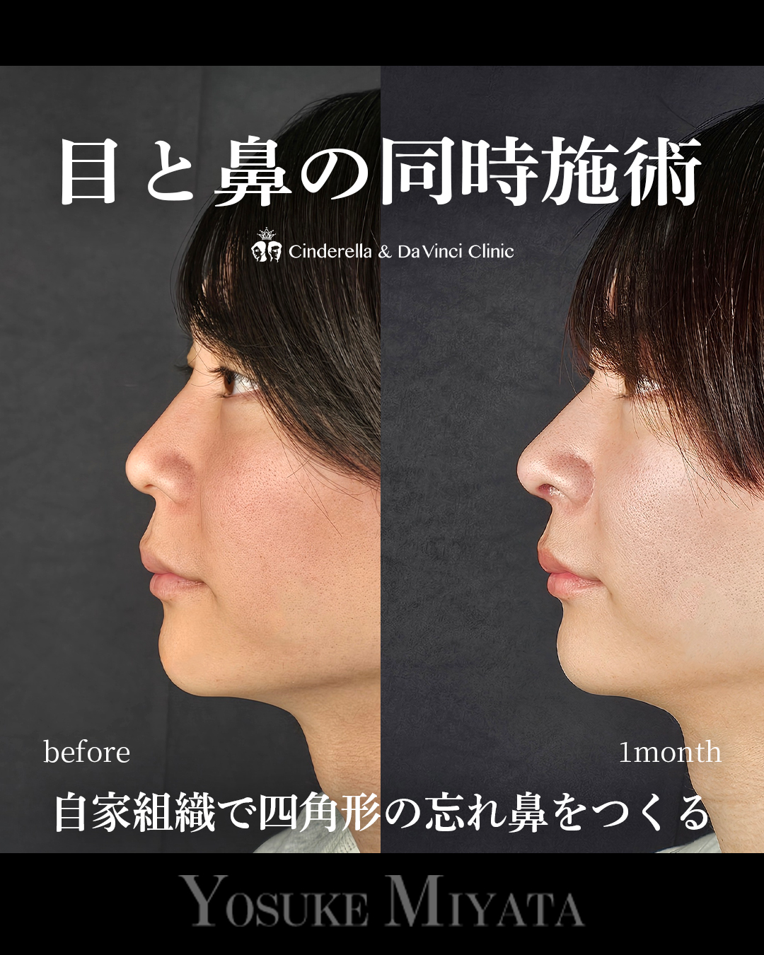 目と鼻同時の画像