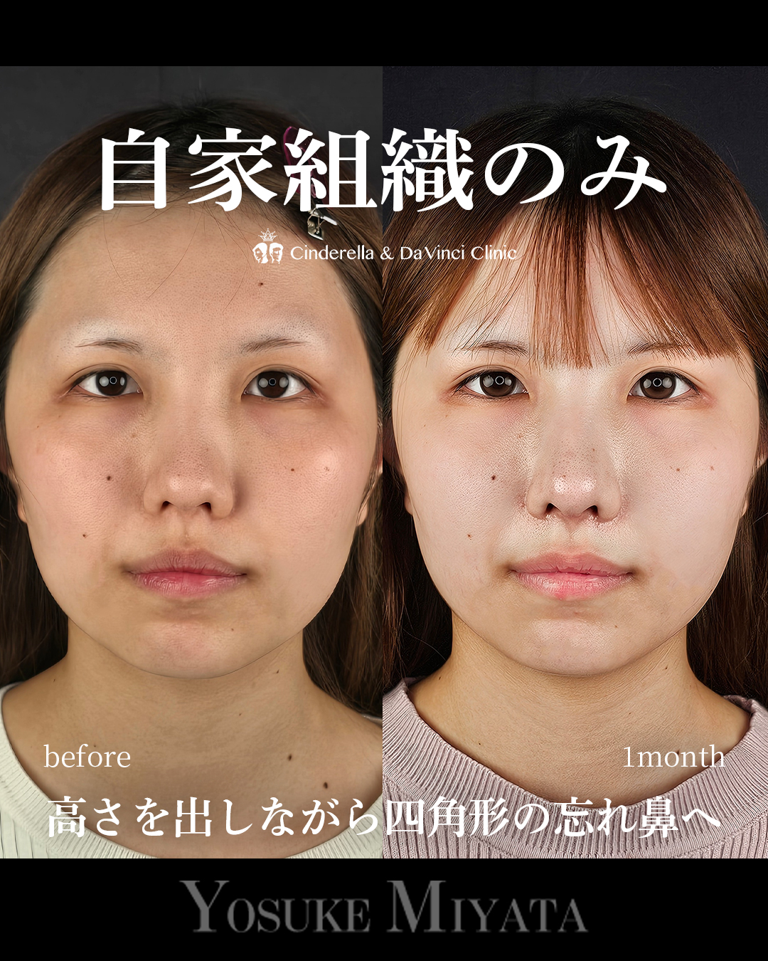 自家組織のみの画像