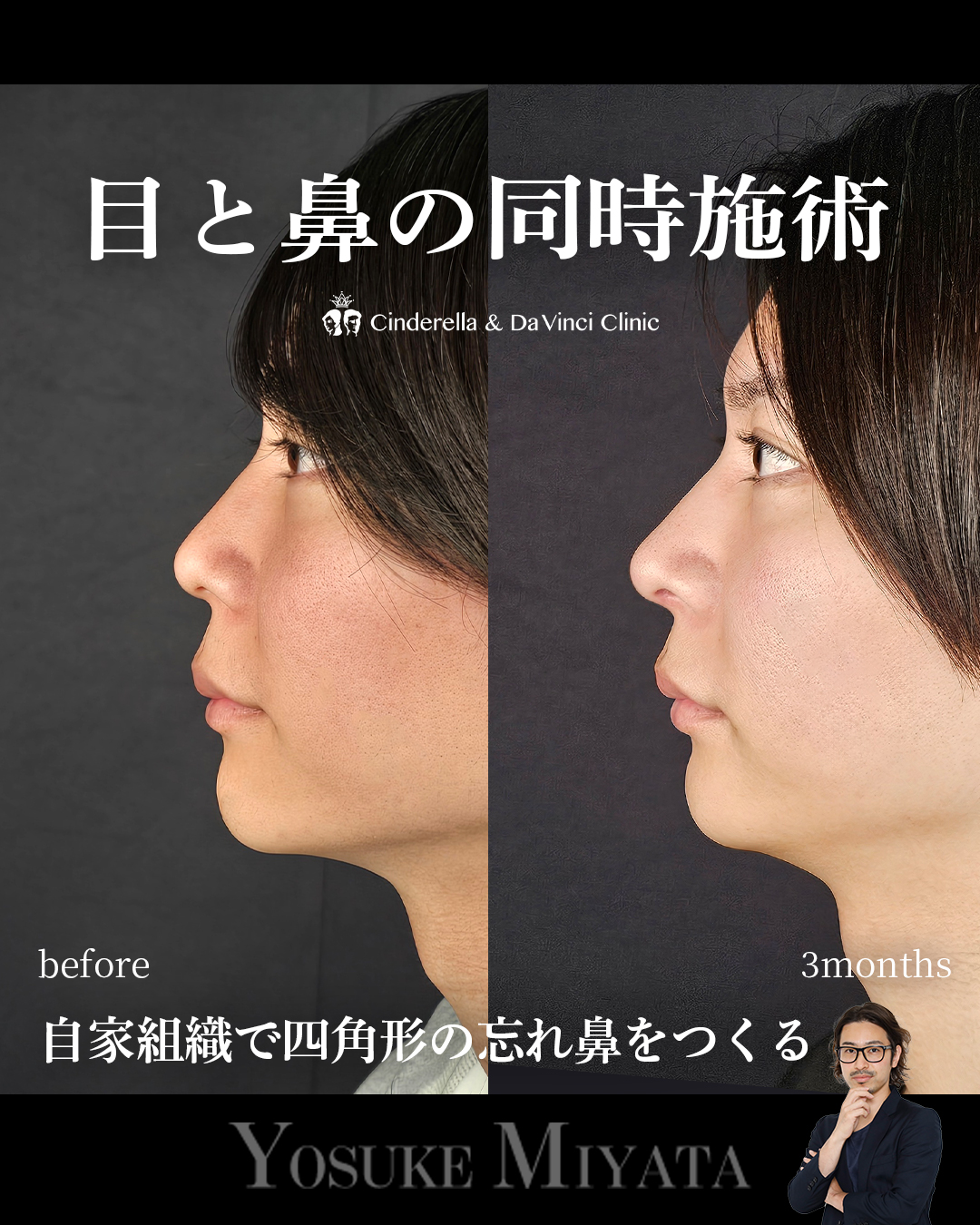目と鼻同時の画像