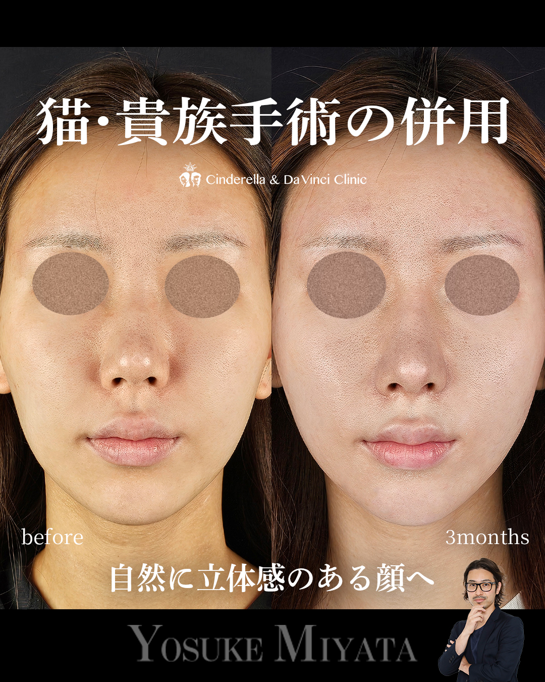 猫・貴族手術の併用の画像