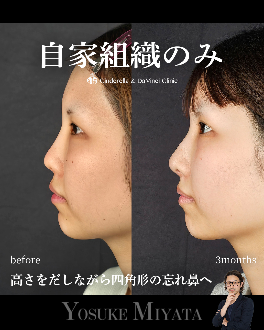 自家組織のみの画像