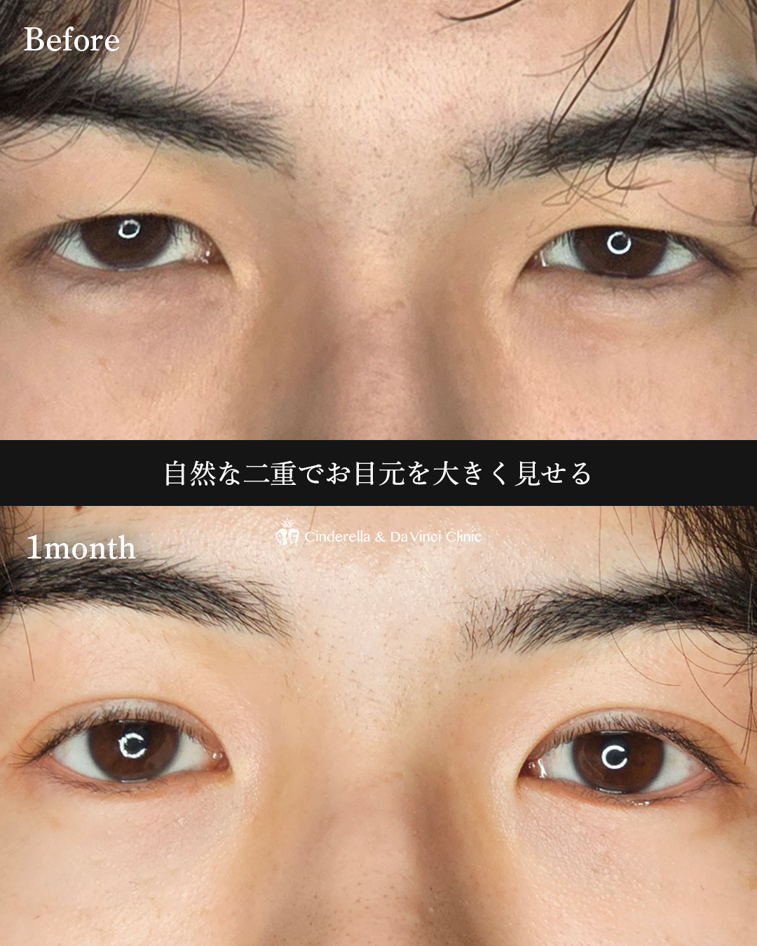 目元を大きくの画像