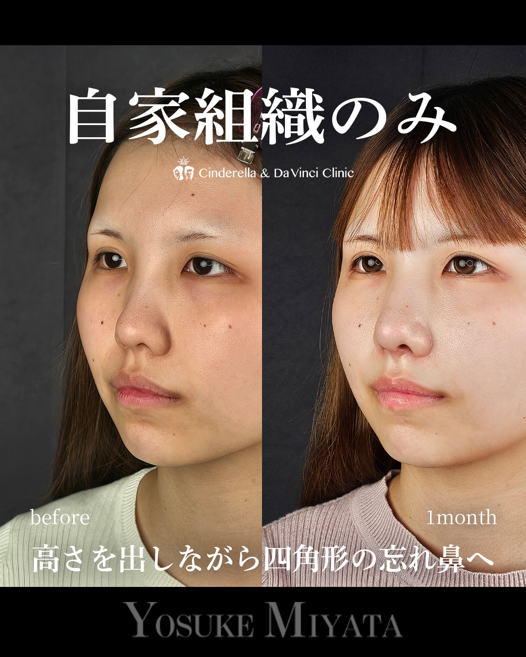 自家組織のみの画像