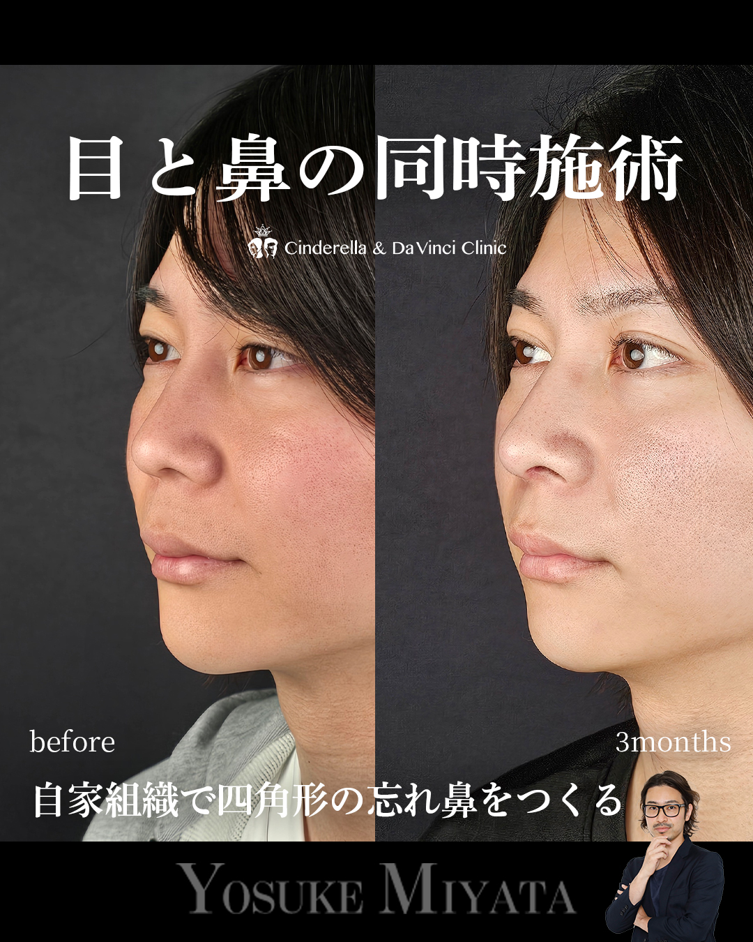 目と鼻同時の画像