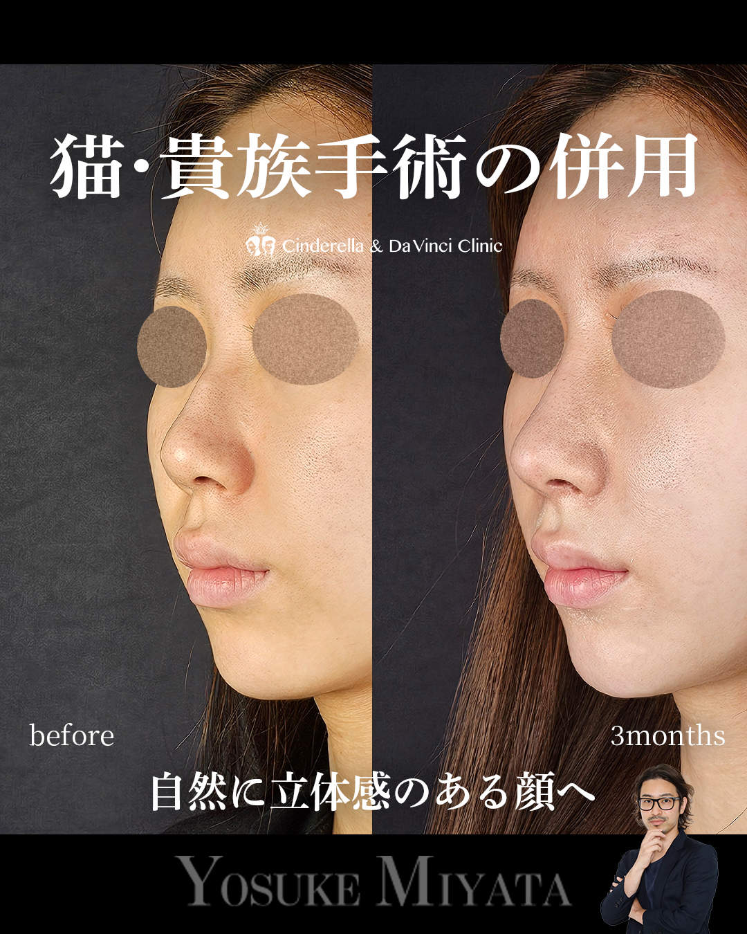 猫・貴族手術の併用の画像