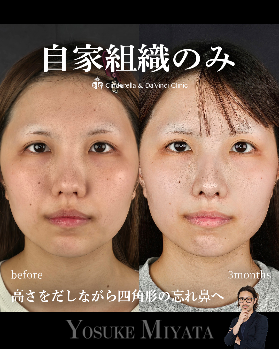 自家組織のみの画像