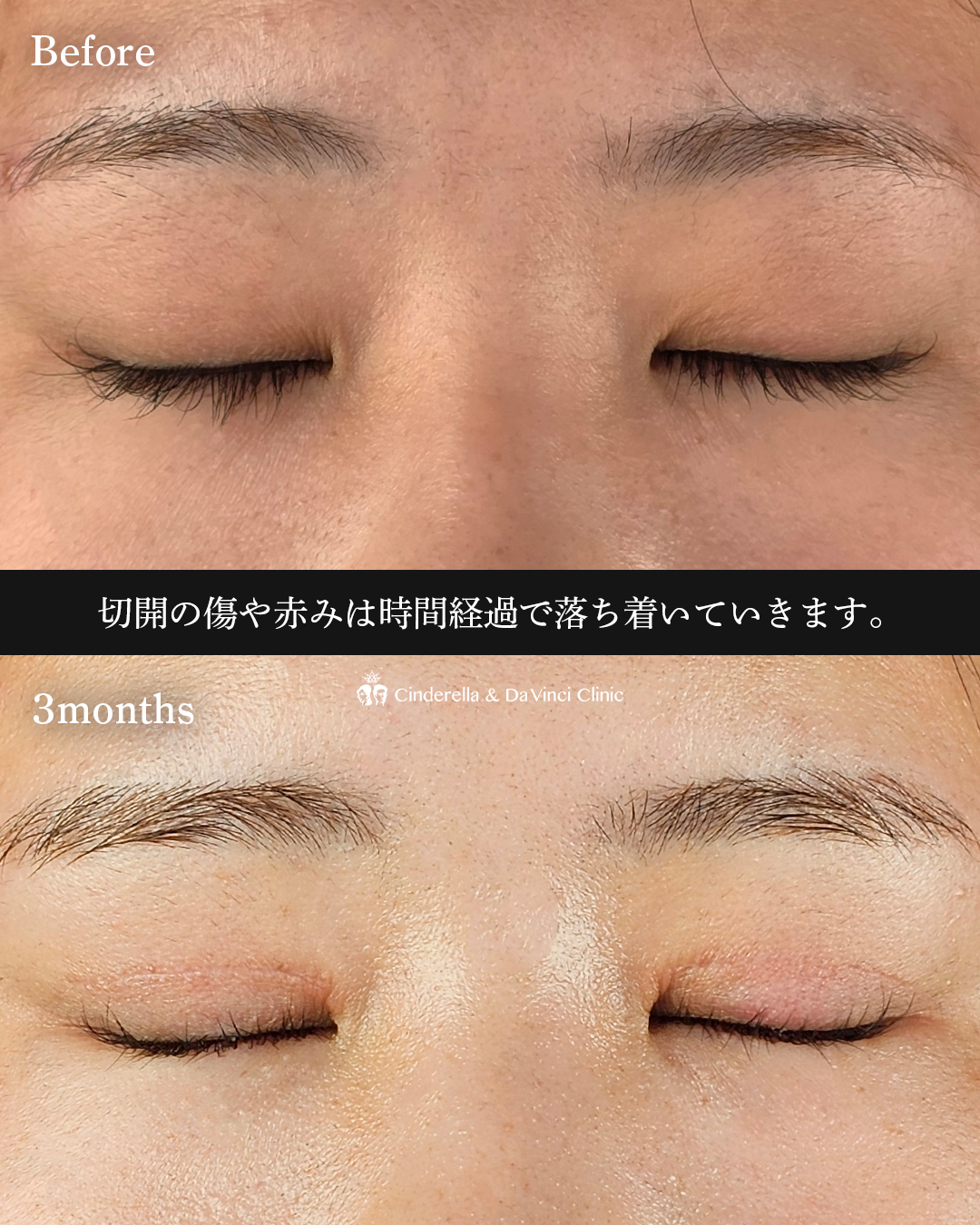 目元ぱっちりの画像