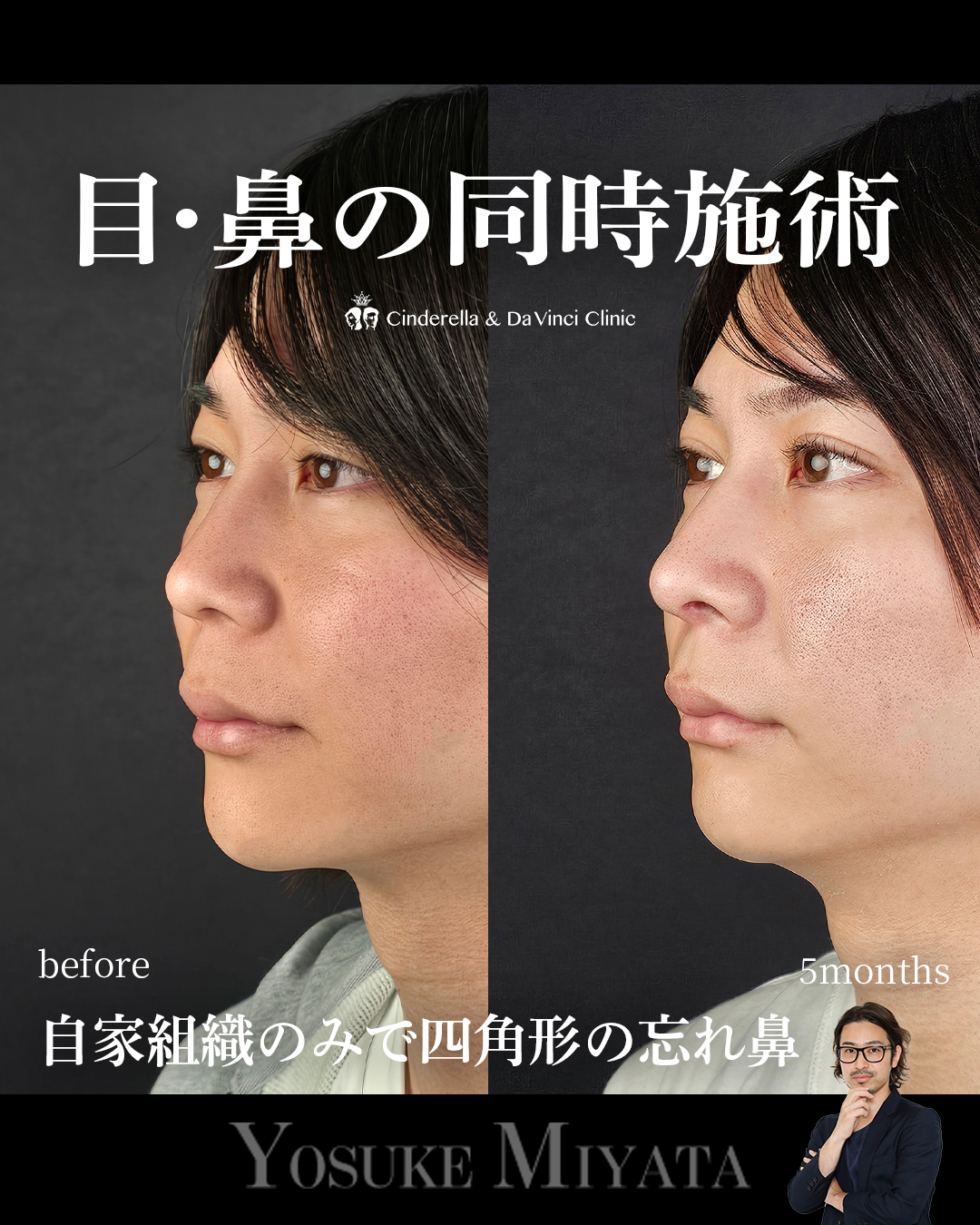 目と鼻同時の画像
