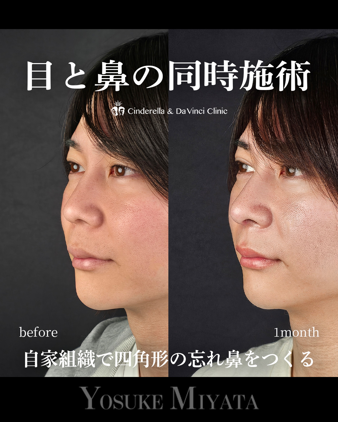目と鼻同時の画像