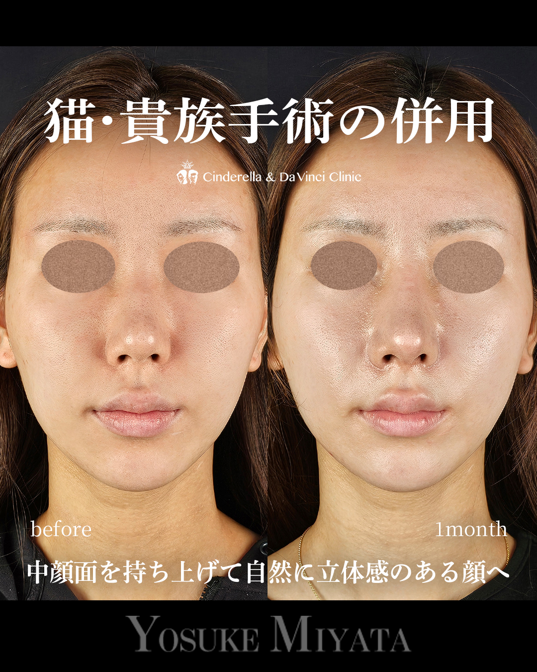 猫・貴族手術の併用の画像