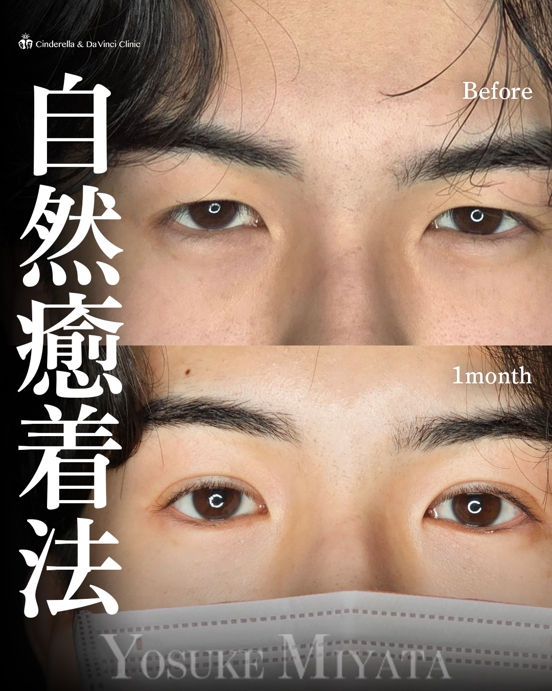 目元を大きく