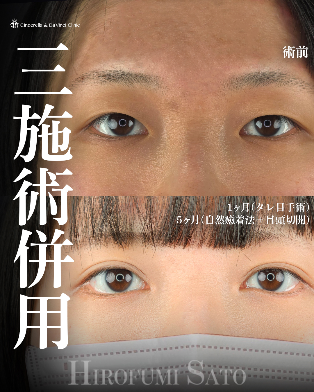 三施術併用