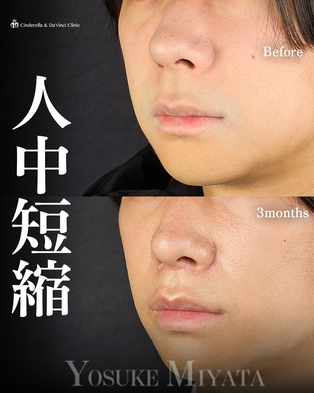 メリハリのある印象へ