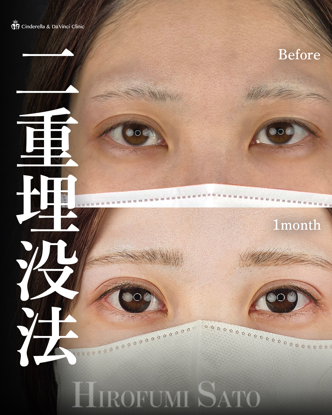 左右差を整える