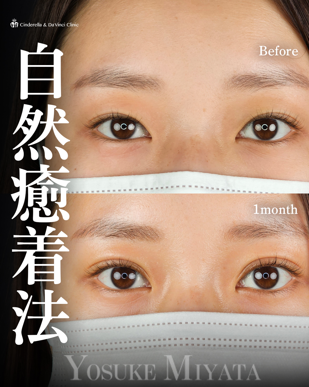 平行二重で華やかに