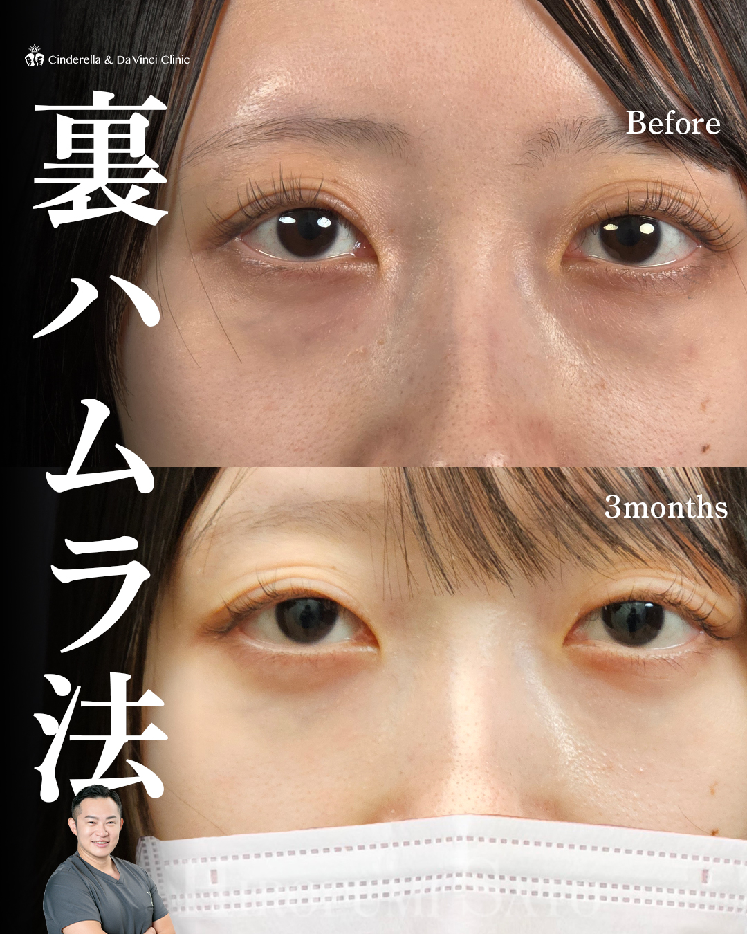 どんよりクマ改善の画像