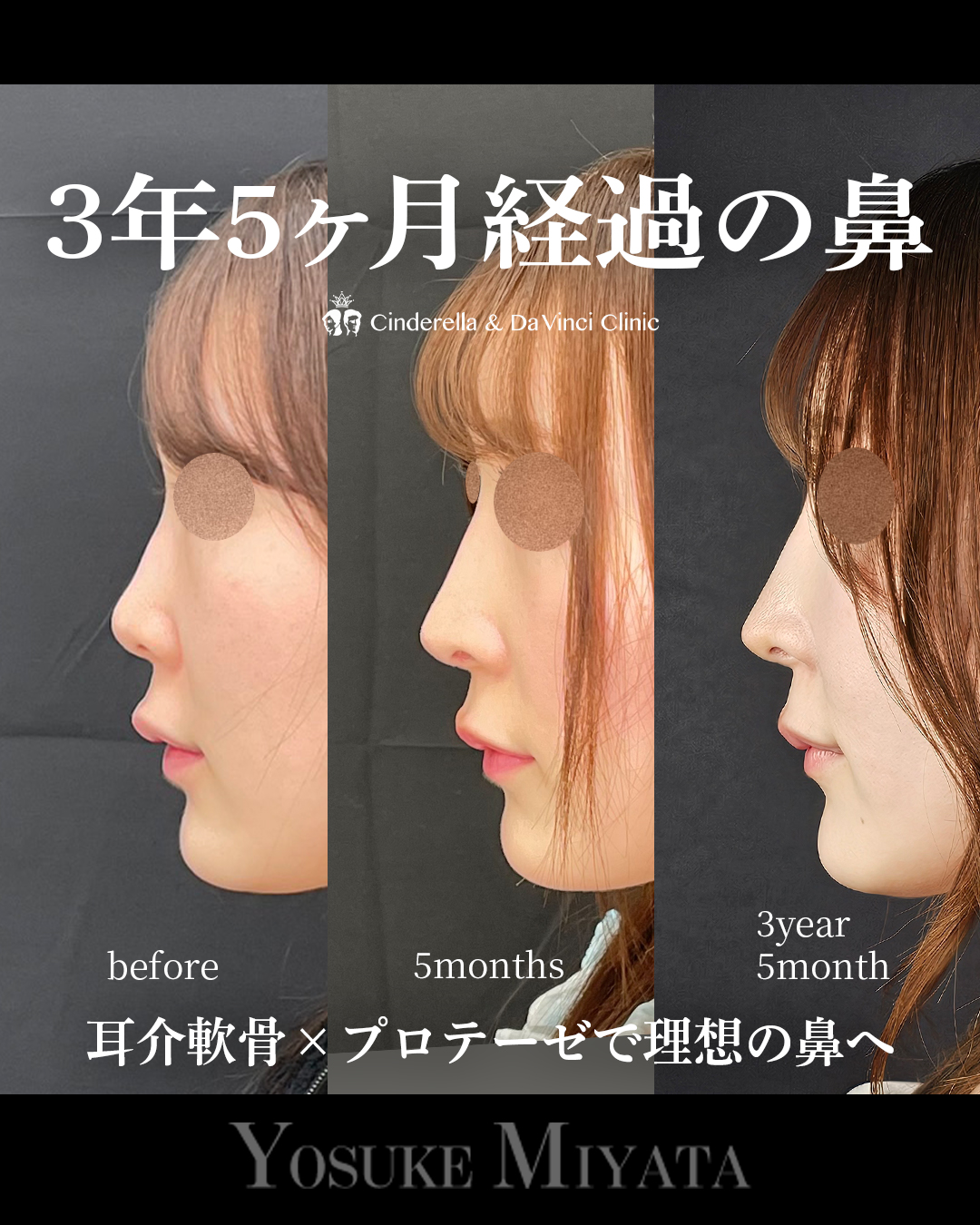 ３年５ヶ月経過