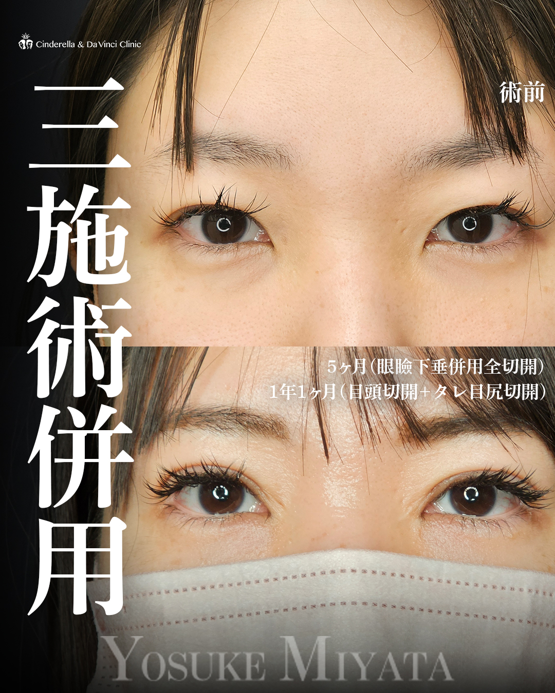 三施術併用