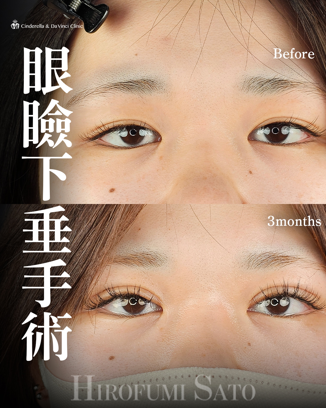 華やかなお目元へ
