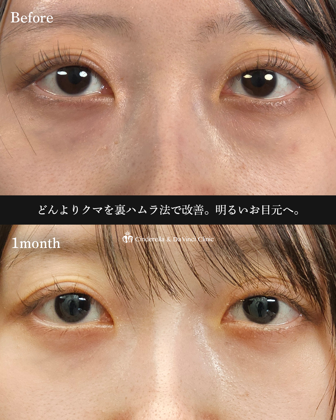どんよりクマ改善の画像