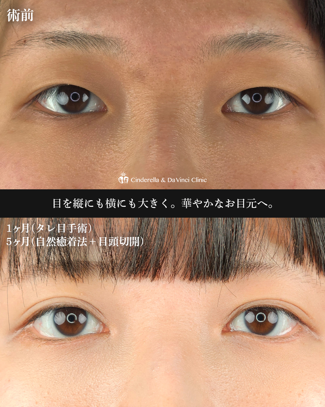 三施術併用の画像