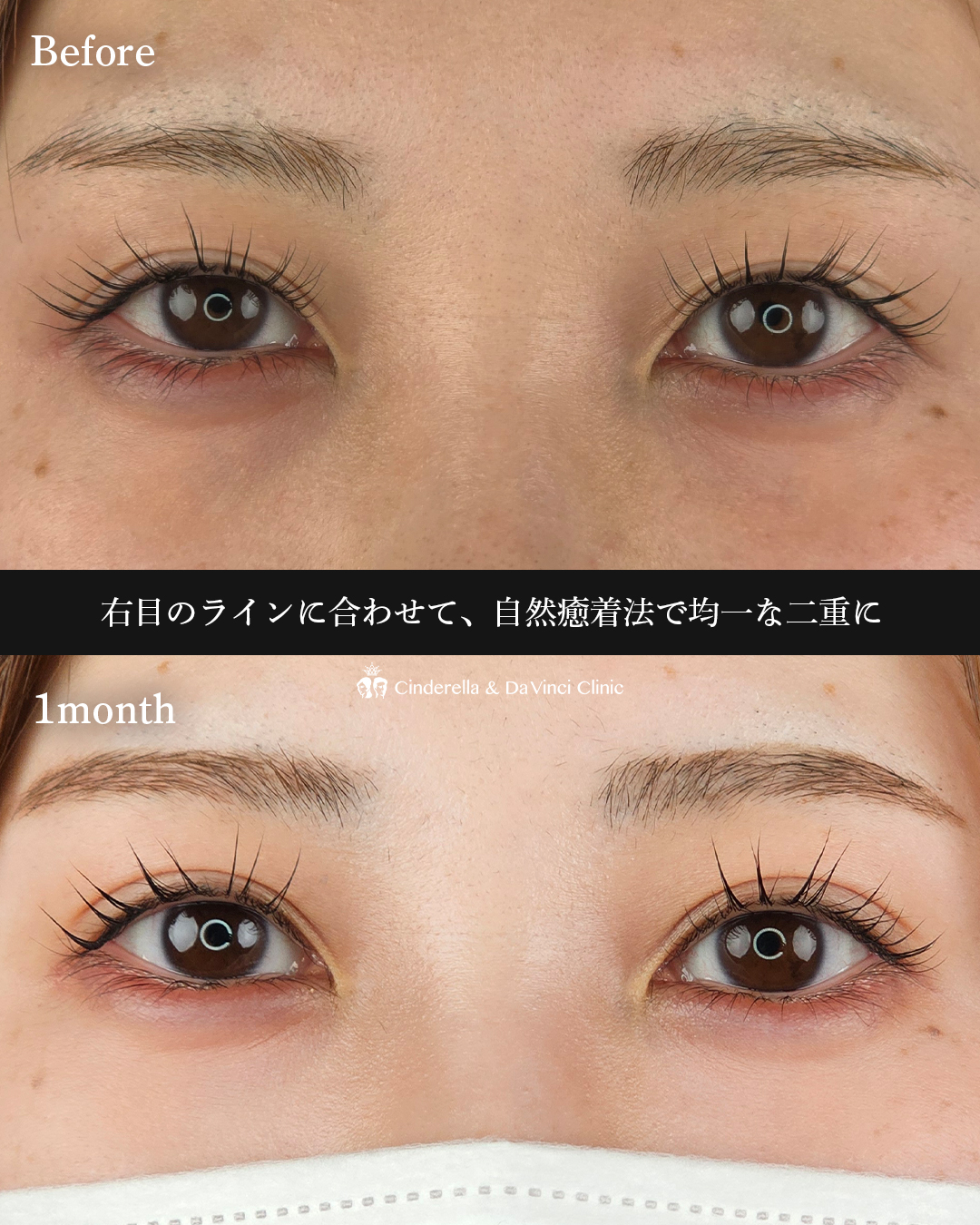 華やかで美しい二重の画像