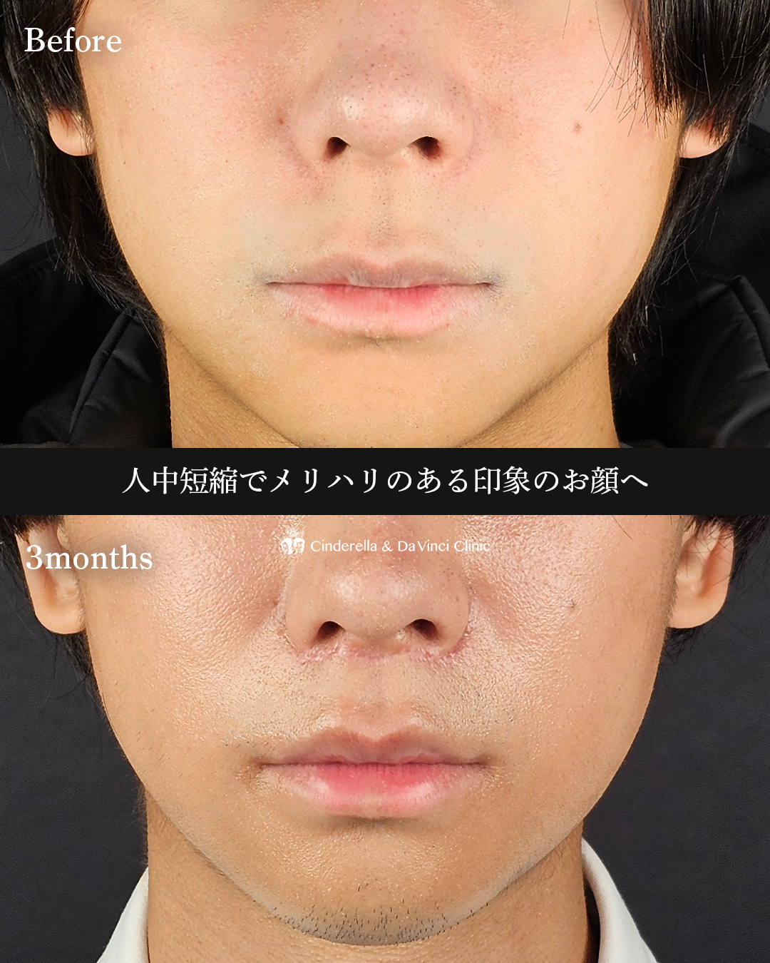 メリハリのある印象への画像