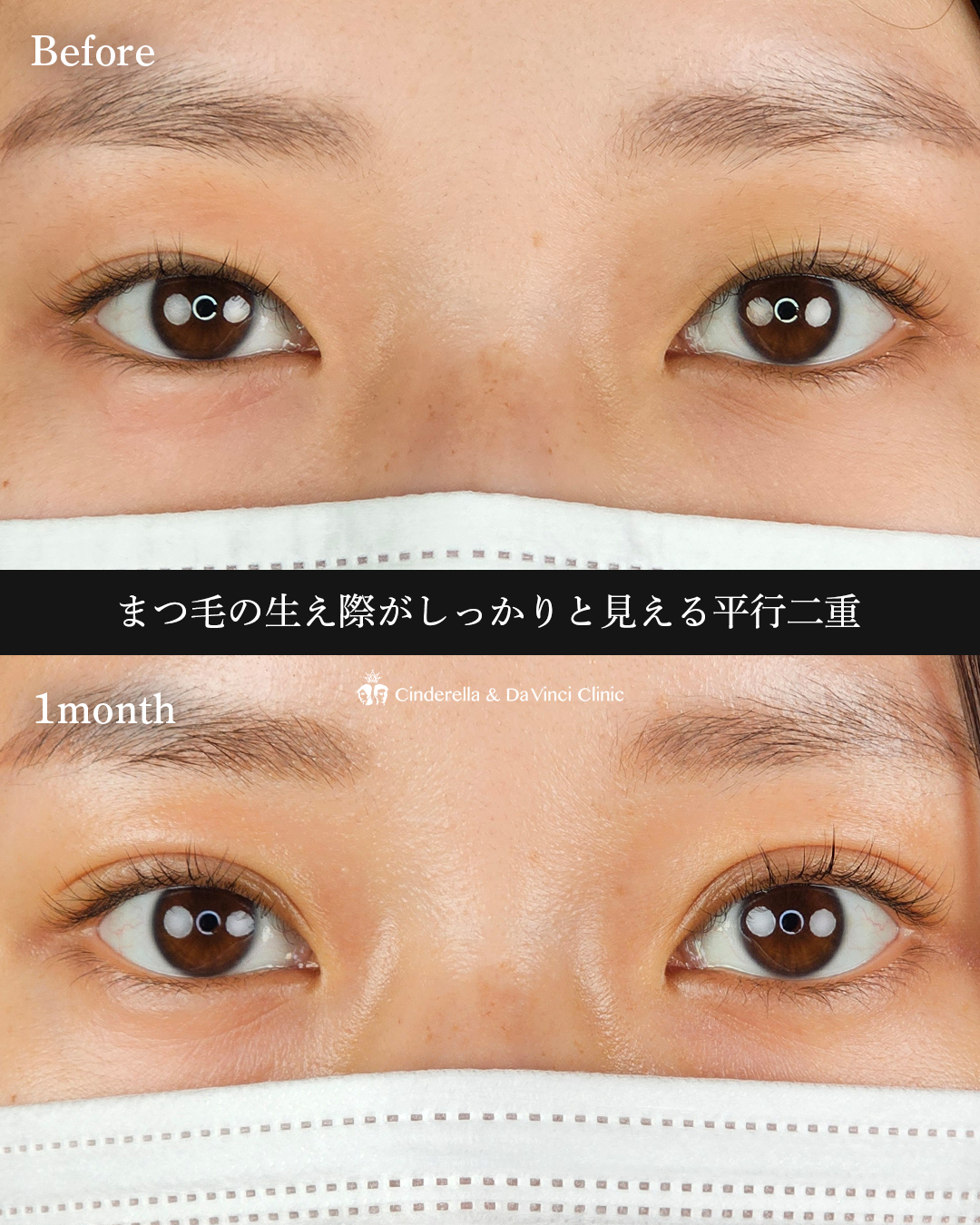 平行二重で華やかにの画像
