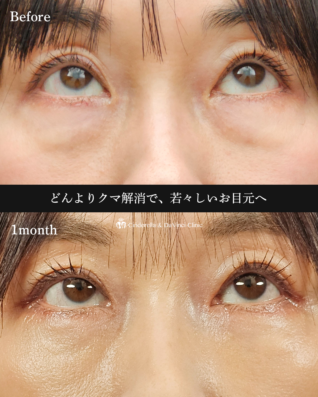 表ハムラ法の画像