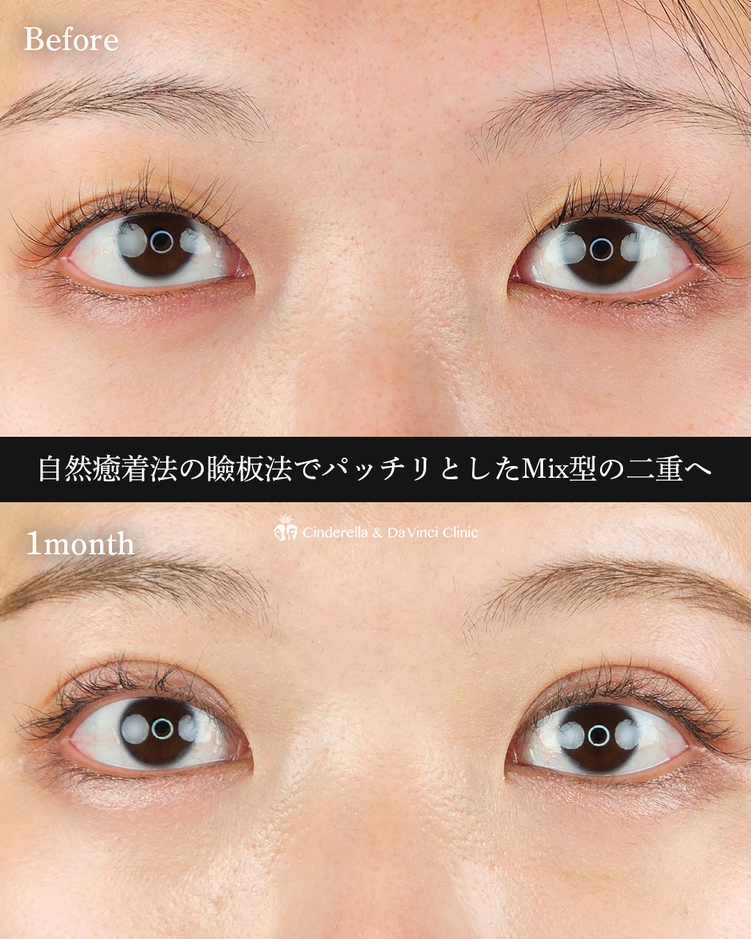 華やかな目元への画像