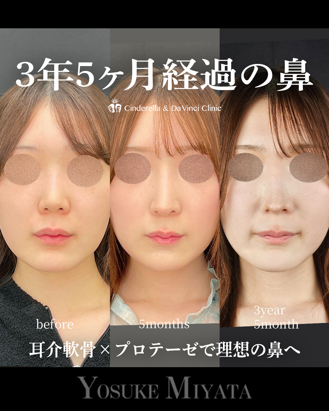 ３年５ヶ月経過の画像