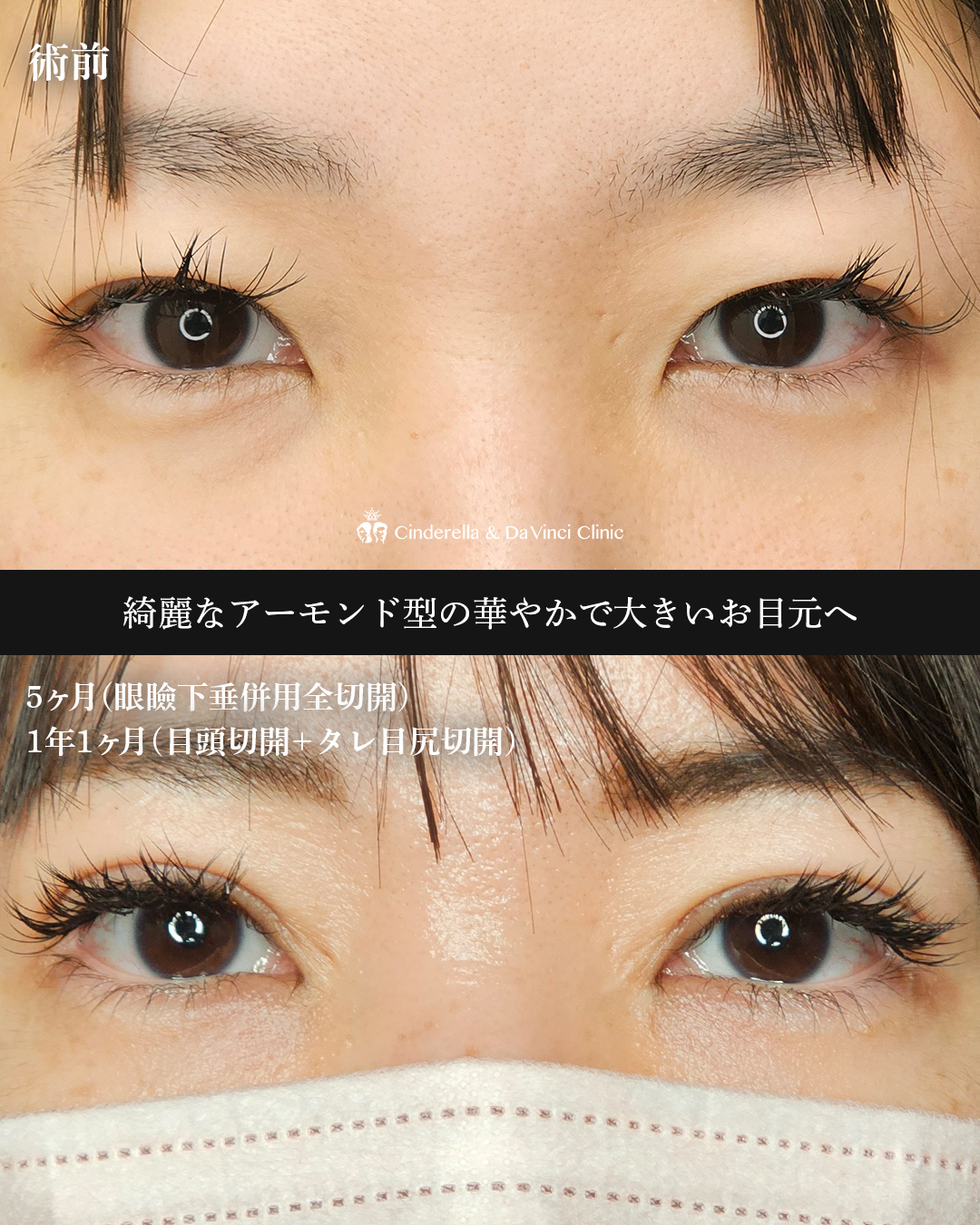 三施術併用の画像