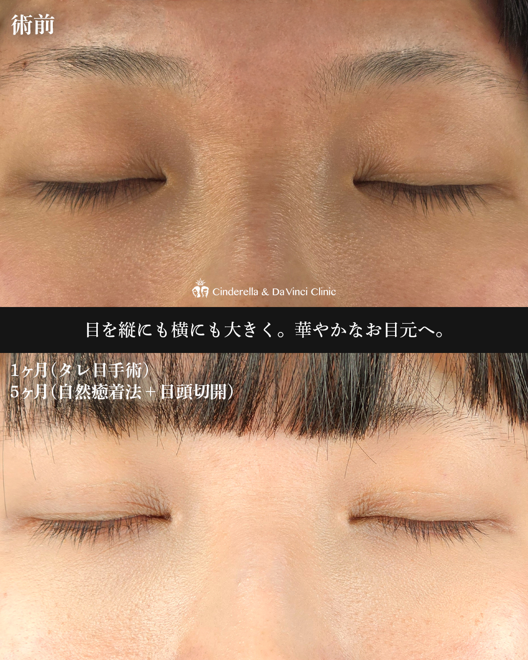 三施術併用の画像