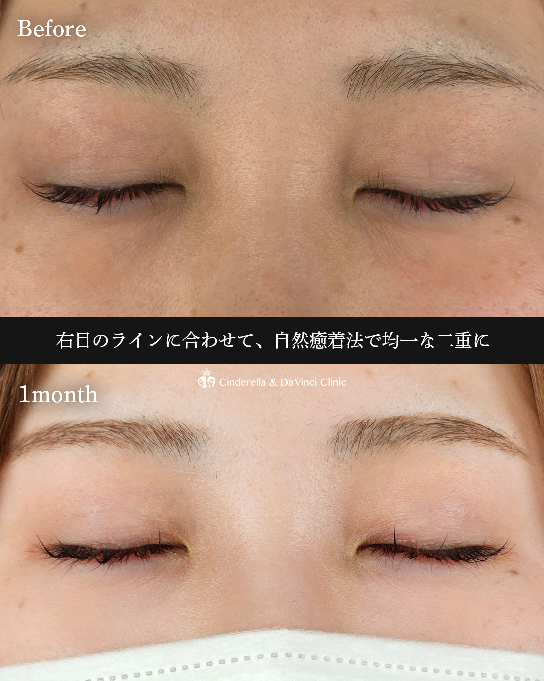 華やかで美しい二重の画像