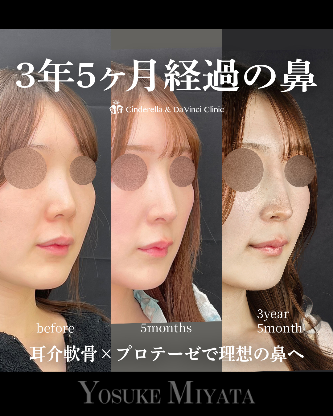 ３年５ヶ月経過の画像