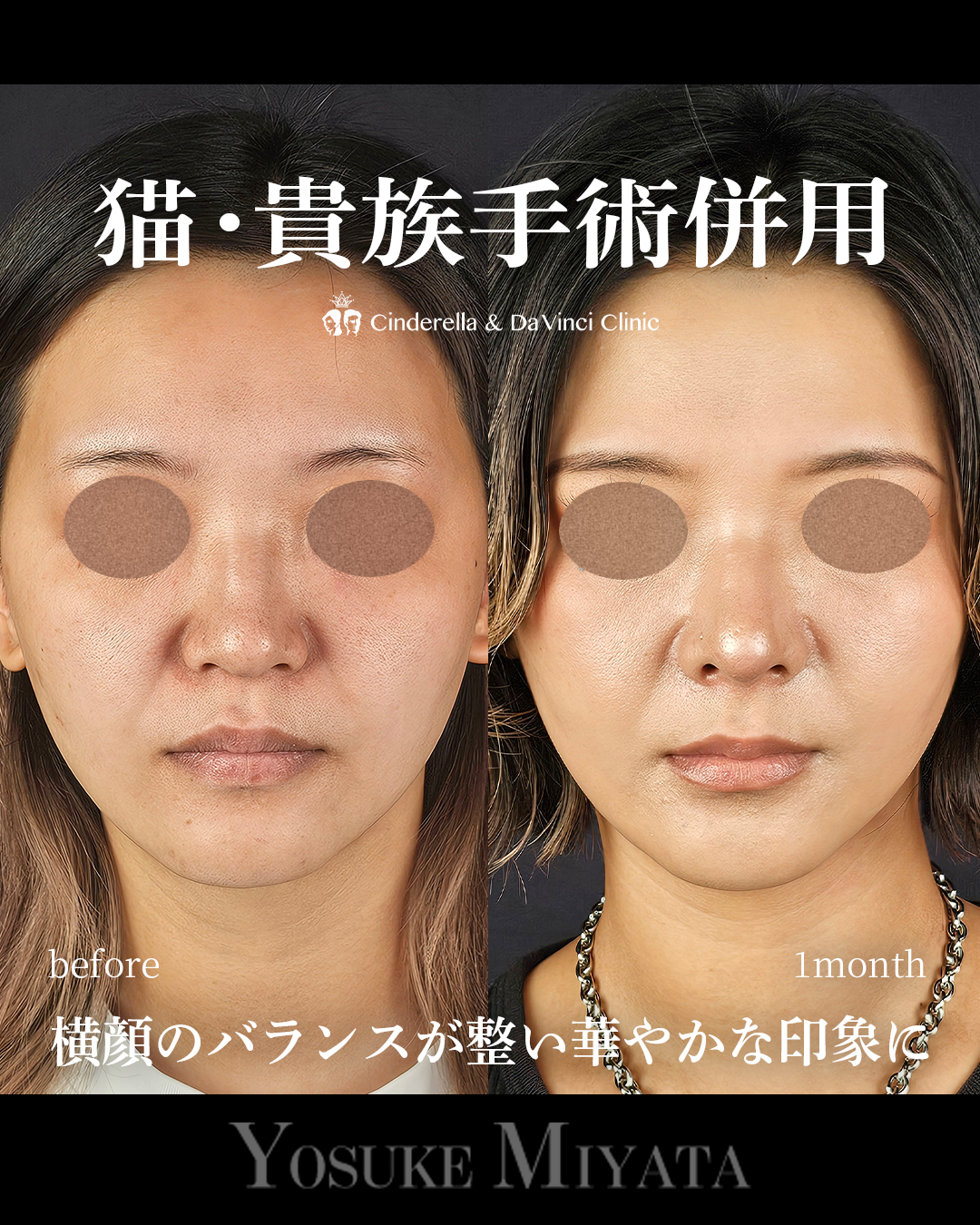猫・貴族手術の併用の画像