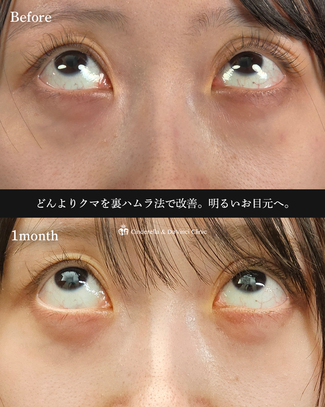 どんよりクマ改善の画像