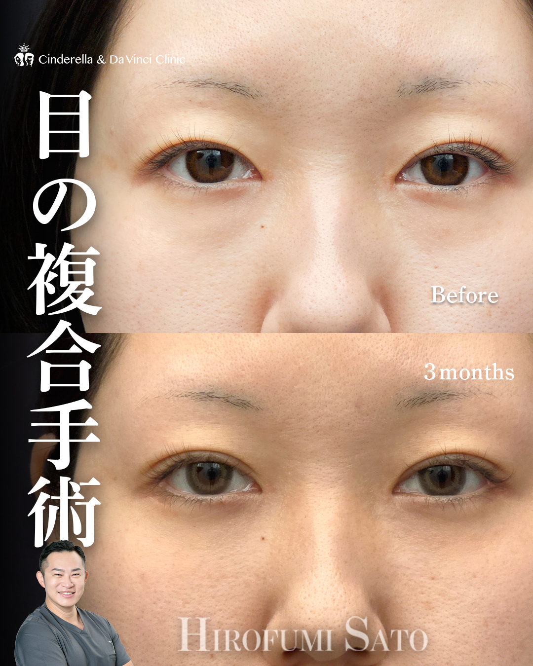 目を横長にする