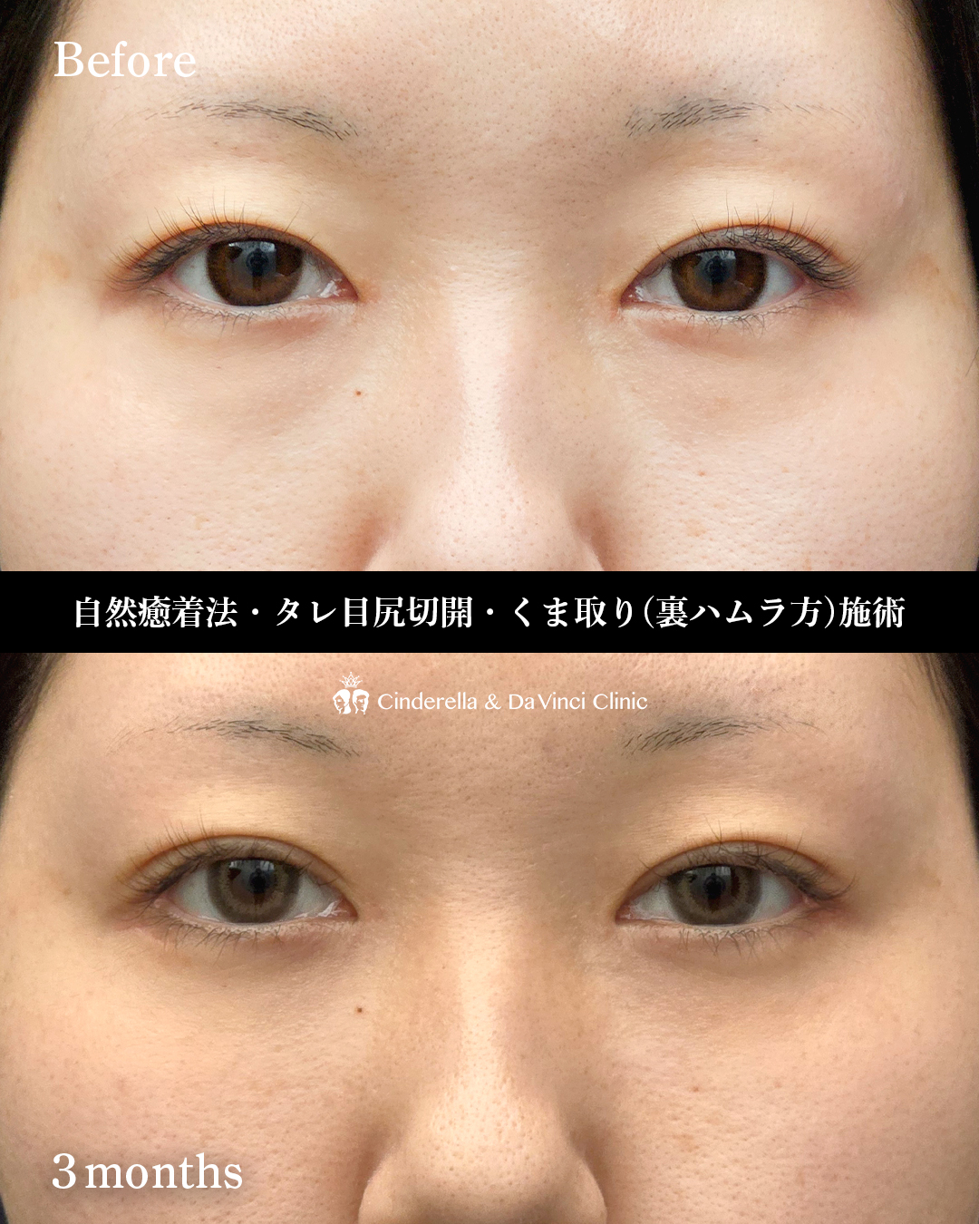 目を横長にするの画像