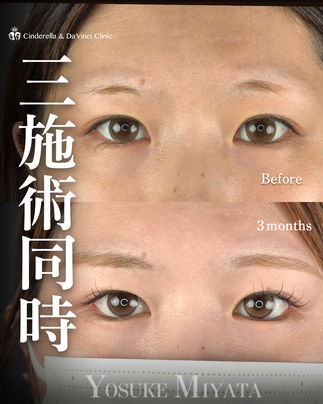目を横と下に広げる