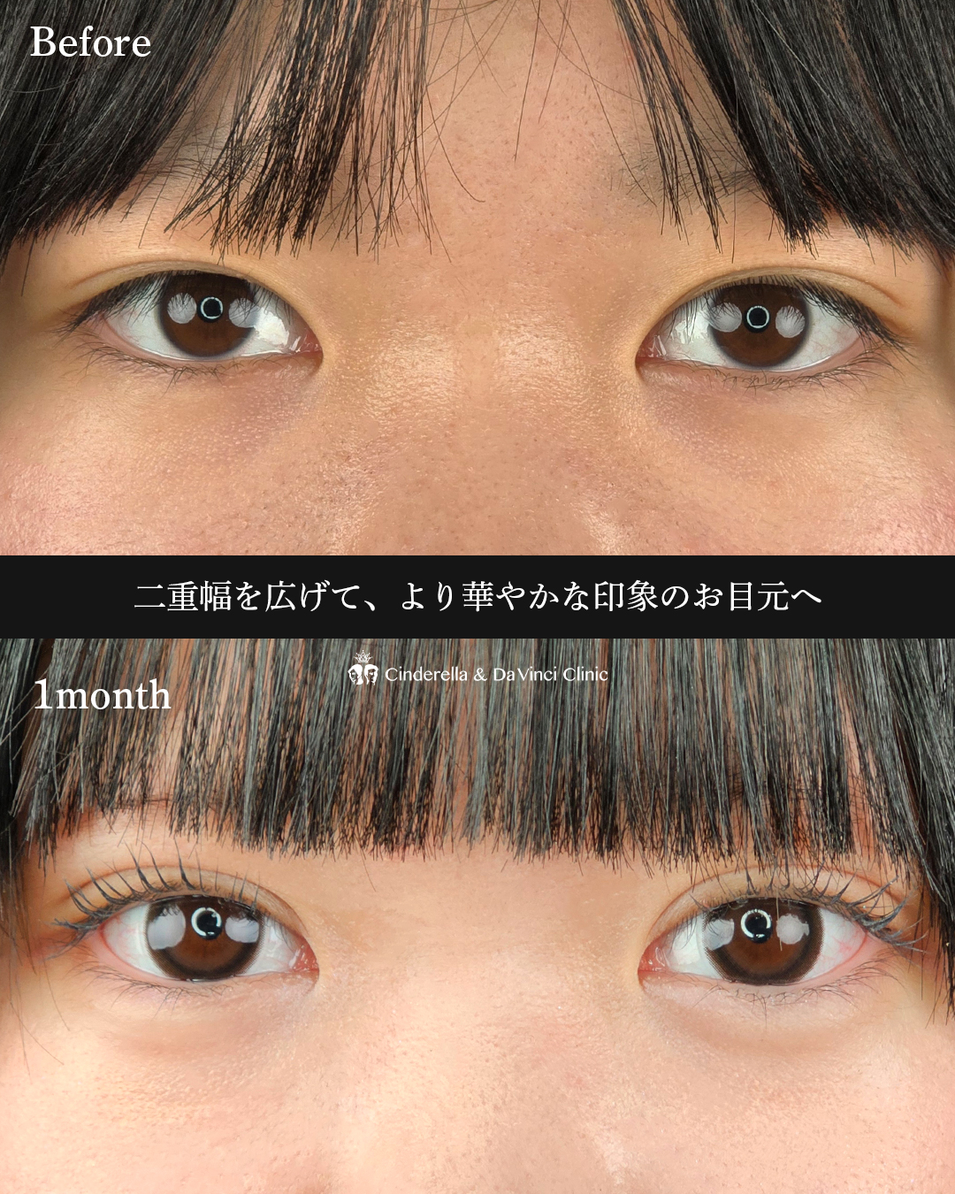 華やかで可愛い二重の画像