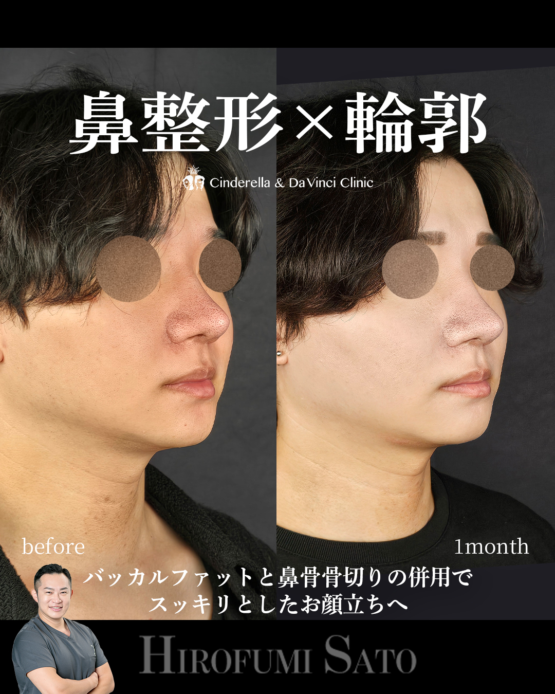 スッキリとした顔立ちへの画像