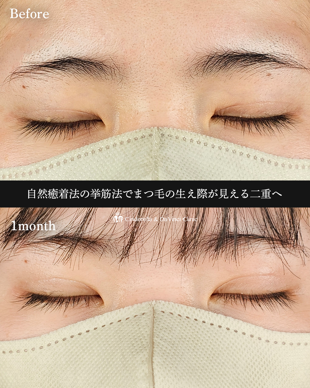 ぱっちり目元への画像