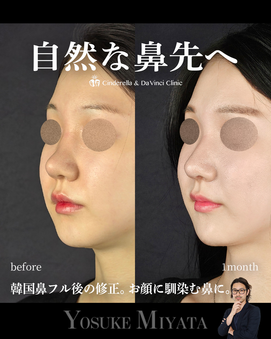 自然な鼻先への画像