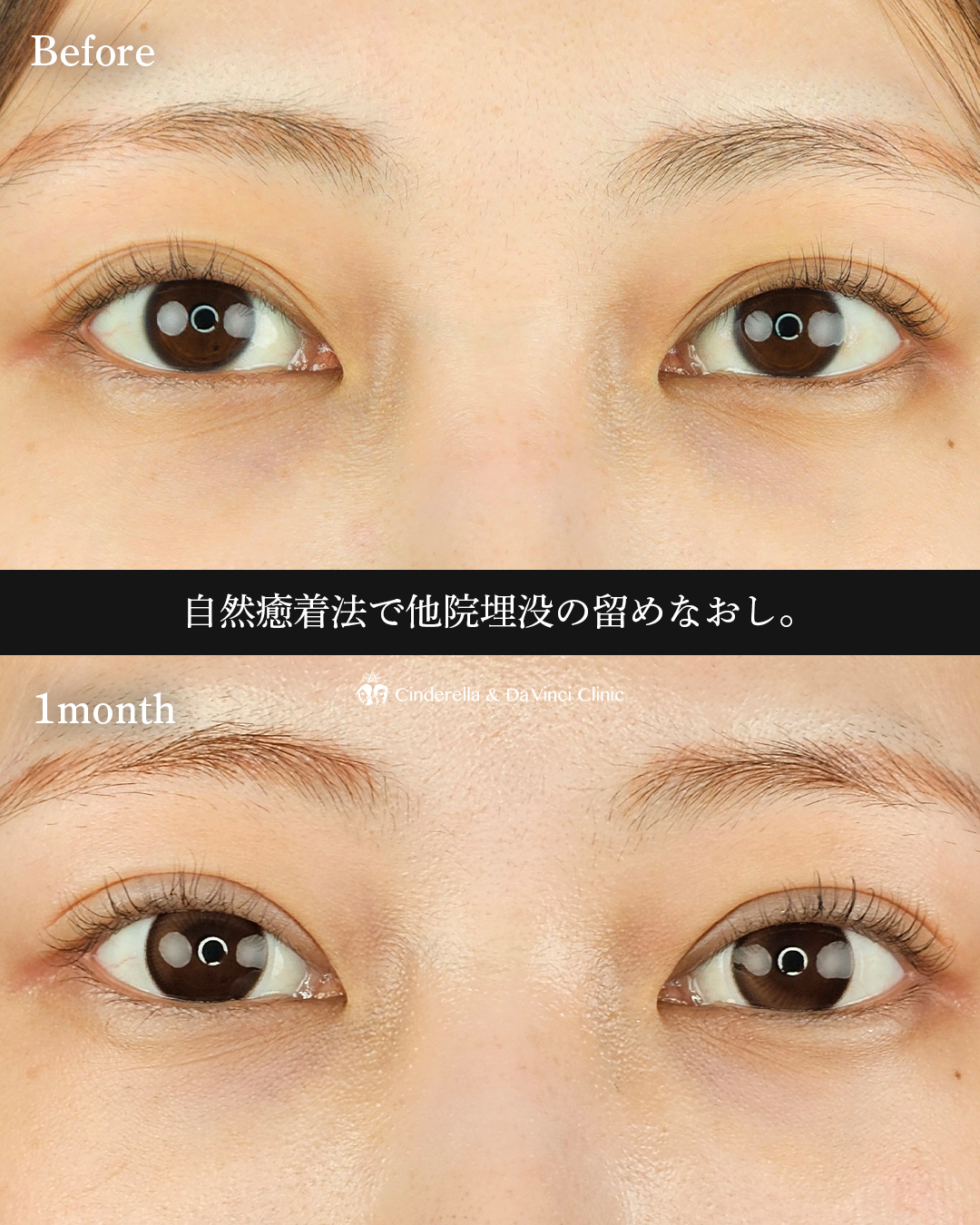 埋没で華やかな目元への画像