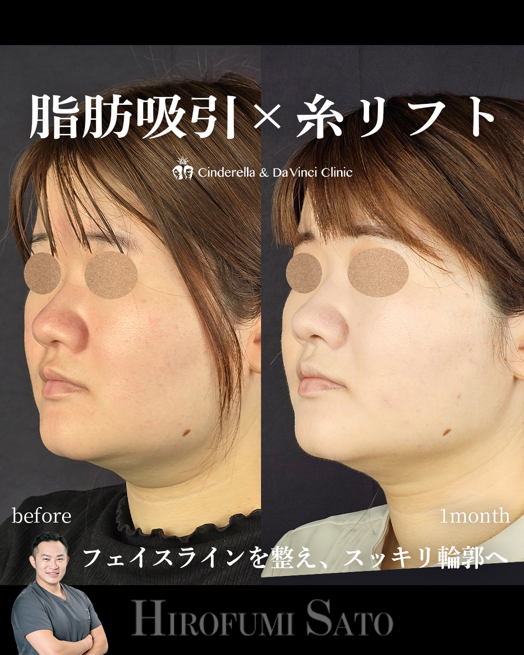 スッキリとした輪郭への画像