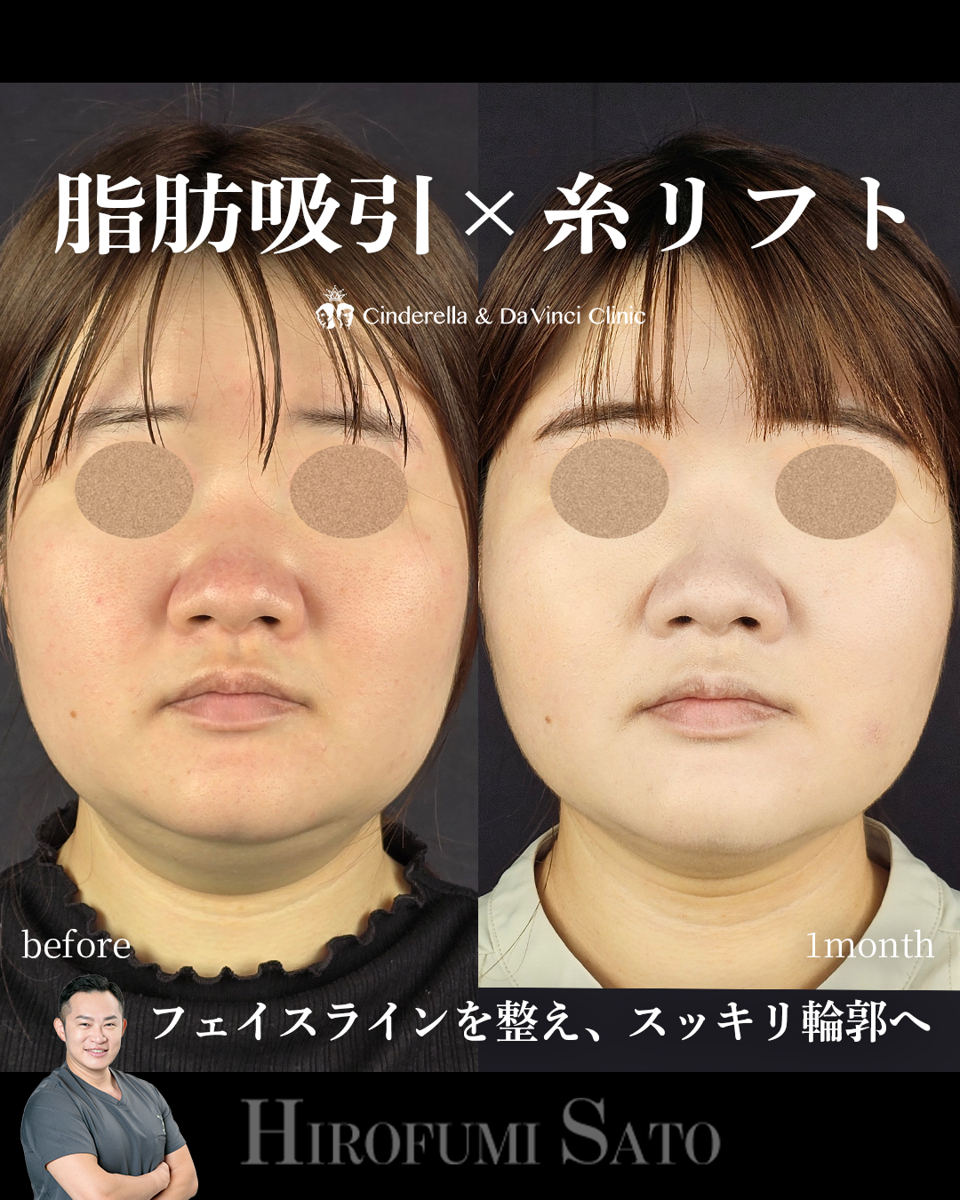 スッキリとした輪郭への画像